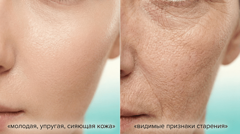 Схема возрастных изменений кожи: снижение коллагена, замедление обновления клеток